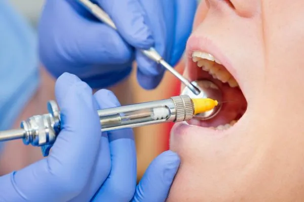 CHIRURGIE DENTAIRE : Approvisionnement du marché de 500 000 doses d’anesthésie