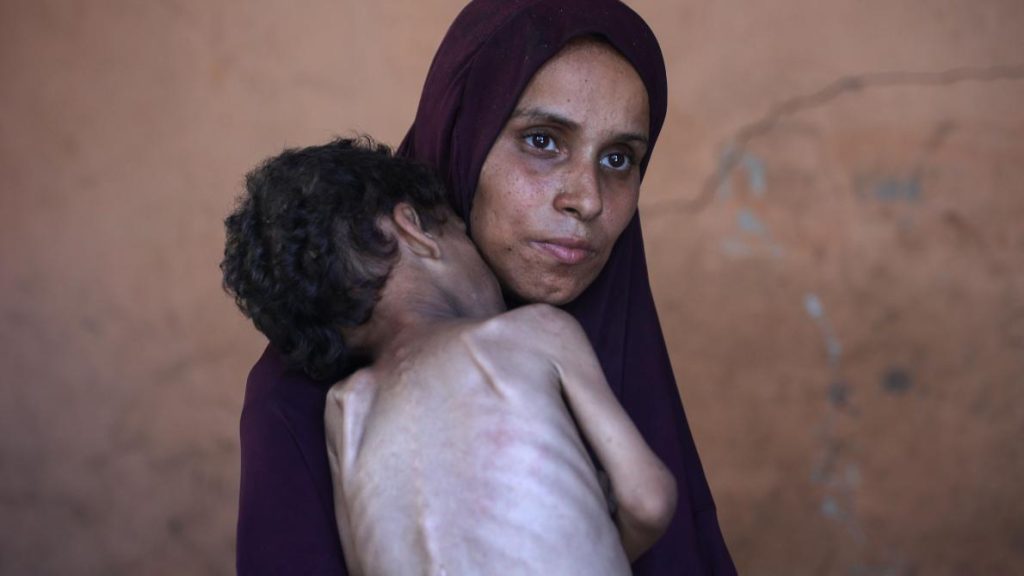 PALESTINE-FAMINE: Des centaines de médecins lancent un SOS pour sauver les enfants de Ghaza